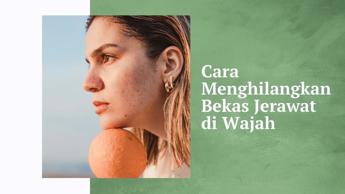 Cara menghilangkan bekas jerawat di wajah