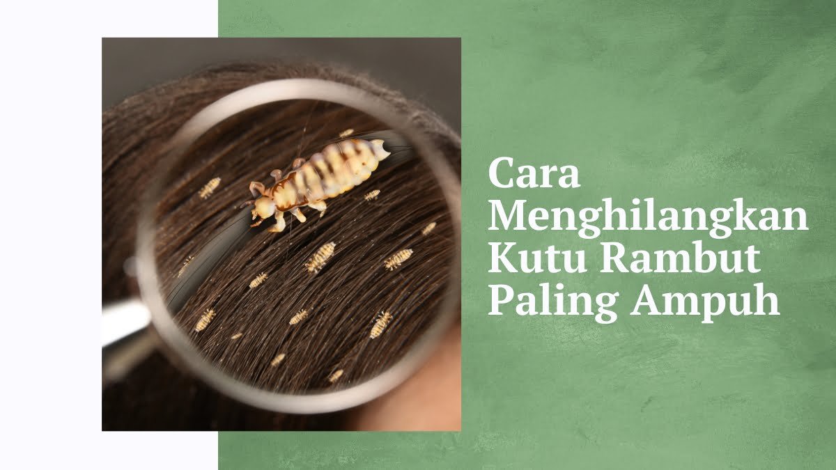 Cara menghilangkan kutu rambut paling ampuh